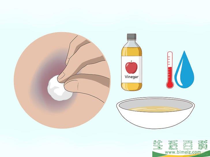 如何快速消除淤青