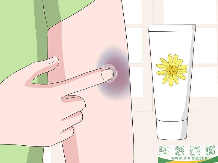 如何快速消除淤青