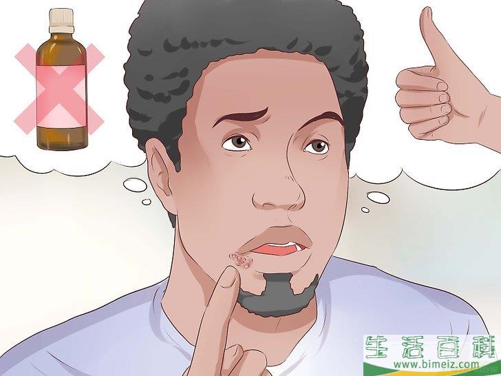 如何判断自己是否得了唇疱疹