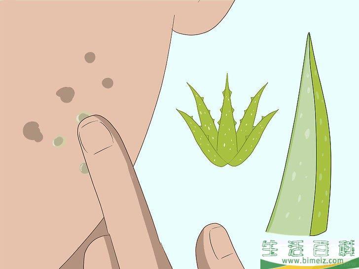 怎么快速祛除痘疤