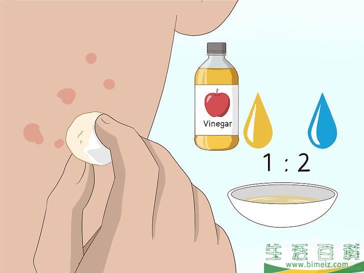怎么快速祛除痘疤