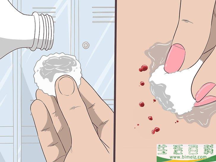 怎么除掉向内生长的阴毛