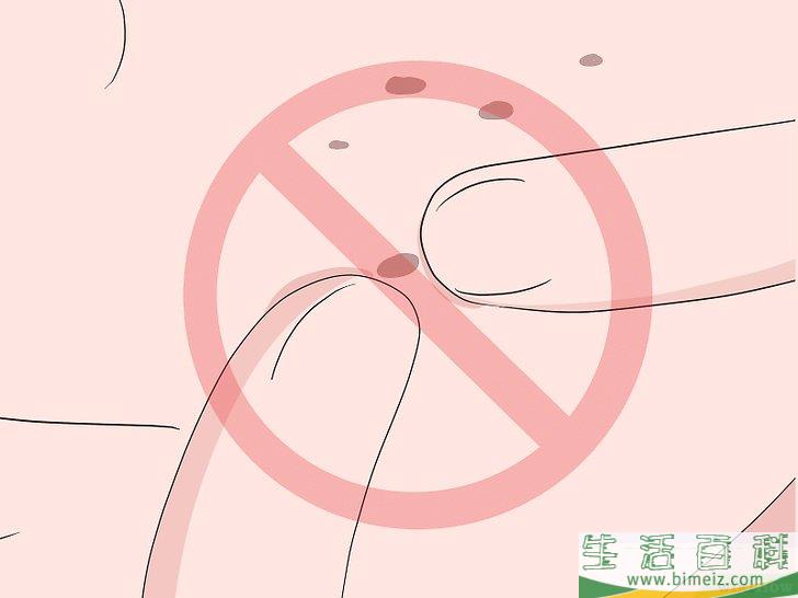 怎么快速祛除痘疤