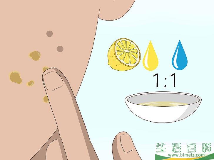 怎么快速祛除痘疤