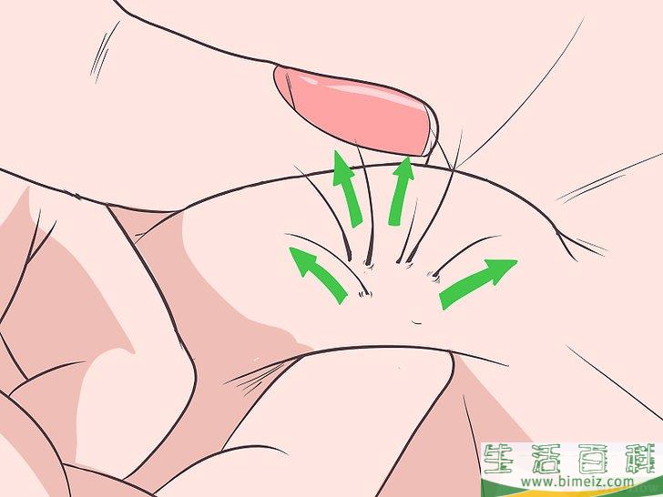 怎么除掉向内生长的阴毛