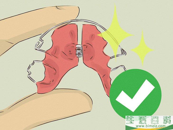 怎么清洁你的牙套