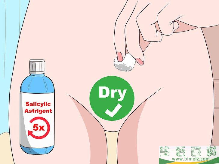 怎么除掉向内生长的阴毛