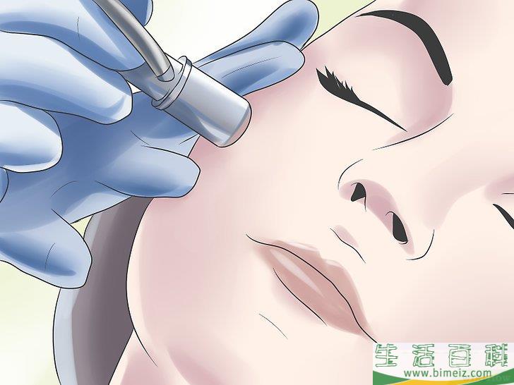 怎么去除老年斑