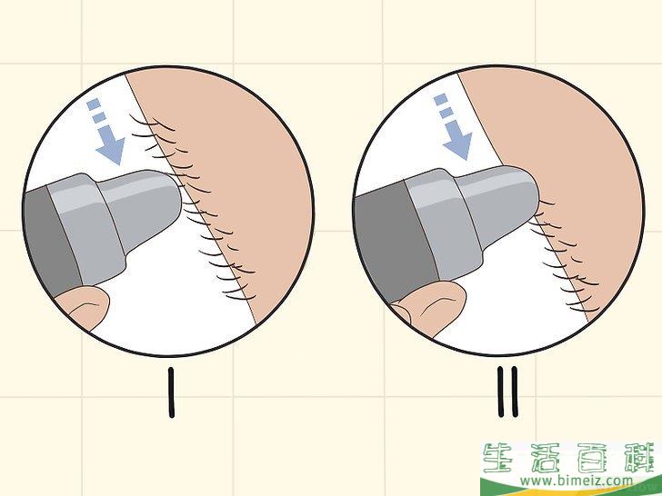 怎么去除腋毛
