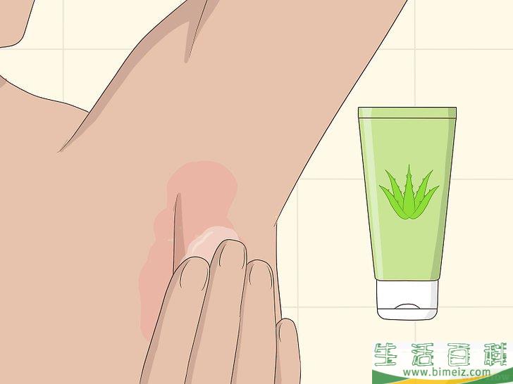怎么去除腋毛