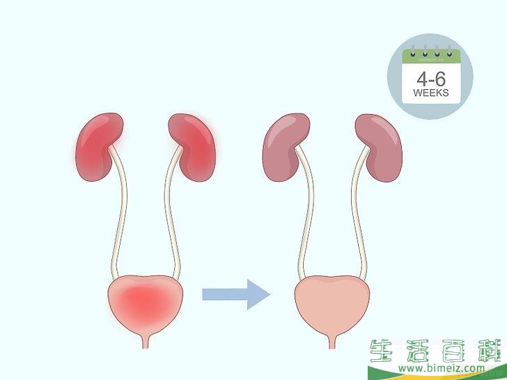 怎么做凯格尔运动