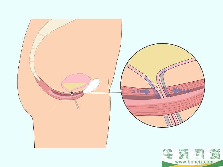 怎么做凯格尔运动