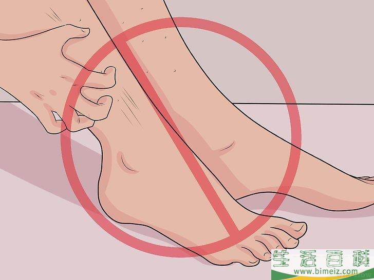 怎么治疗跳蚤叮咬