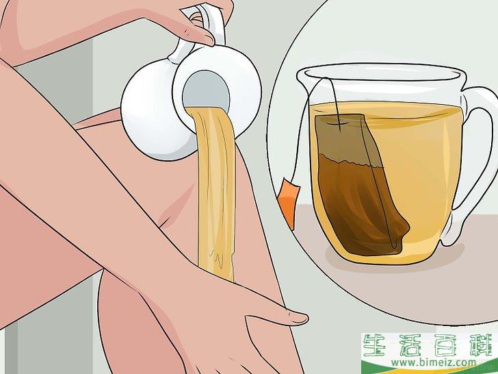 怎么治疗跳蚤叮咬