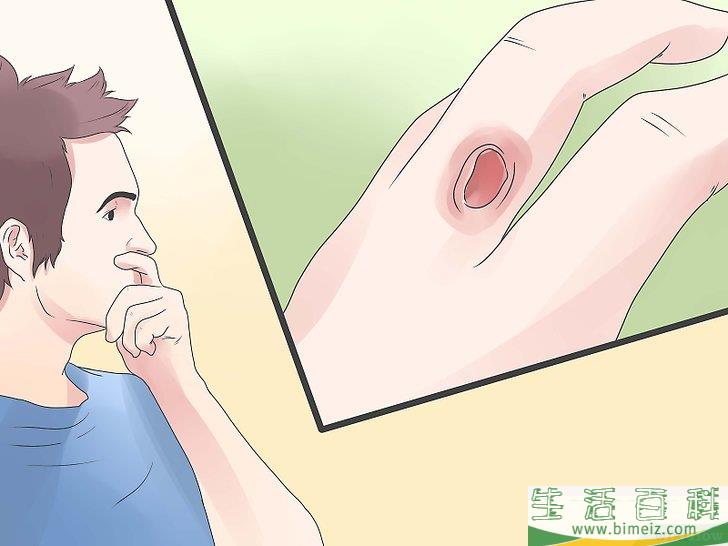 怎么驱除黑寡妇蜘蛛