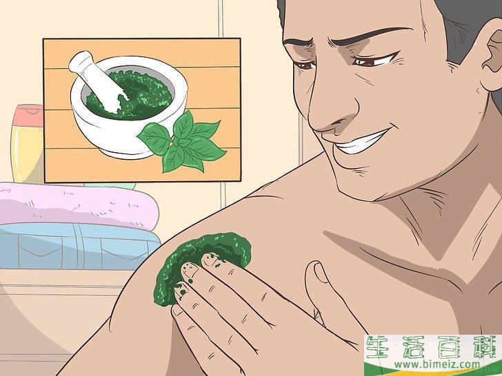 怎么在被蚊子叮后止痒
