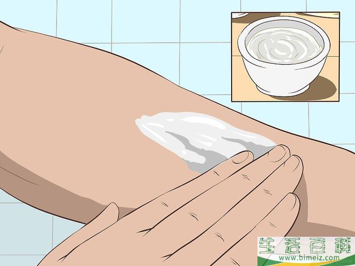 怎么在被蚊子叮后止痒