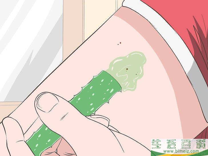 怎么在被蚊子叮后止痒