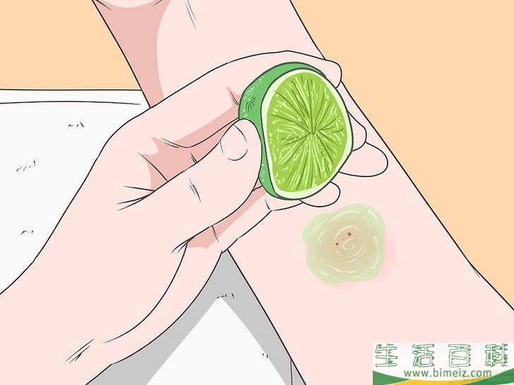 怎么在被蚊子叮后止痒