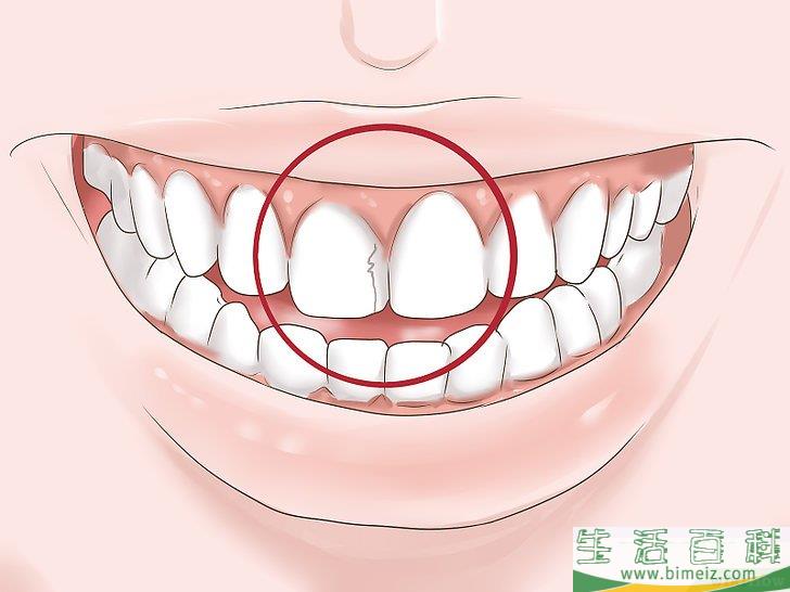 怎么判断自己的补牙材料是否需要更换