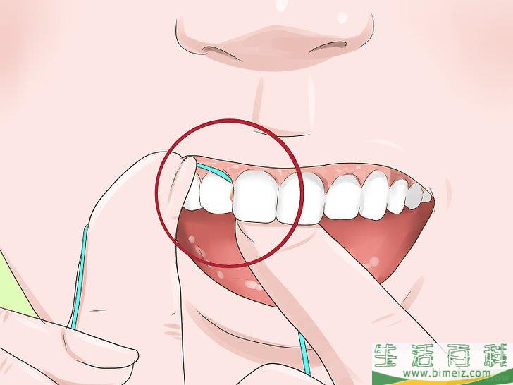 怎么判断自己的补牙材料是否需要更换