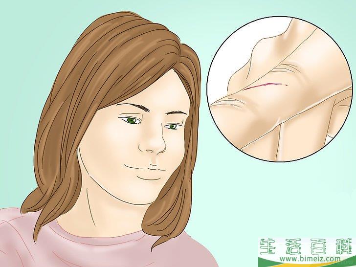 怎么处理纸造成的割伤