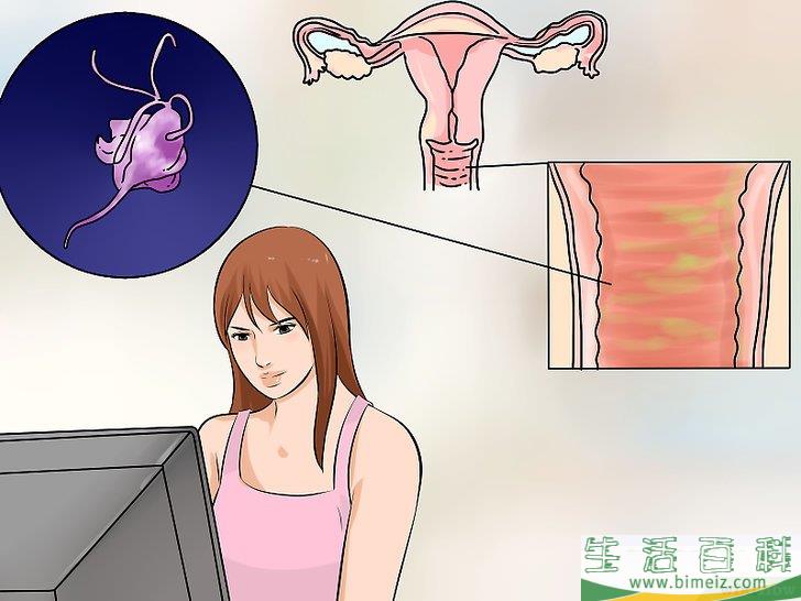 怎么治疗阴道炎