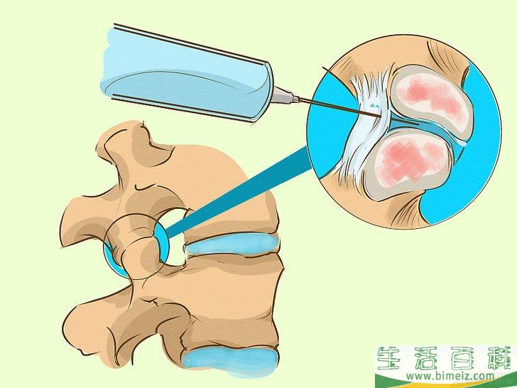 怎么治疗上背痛