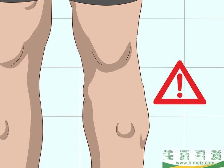 怎么知道自己是否长了脂肪瘤