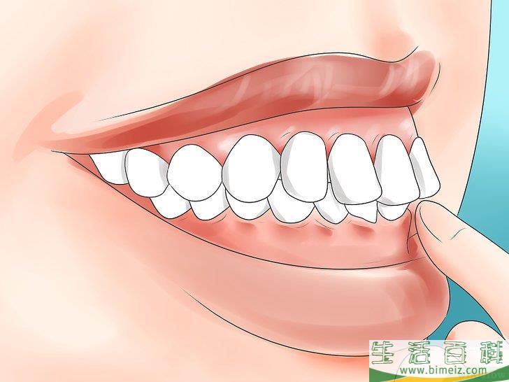 怎么判断自己是否需要矫正牙齿