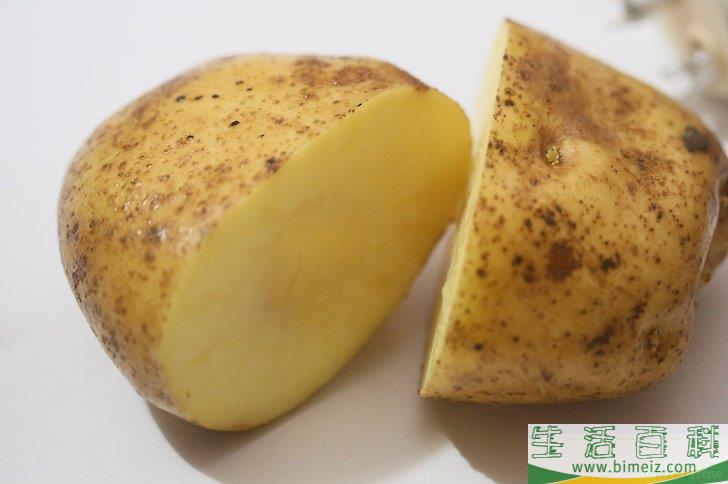 怎么消除眼皮浮肿