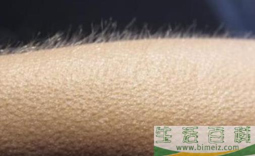 皮肤起鸡皮怎么办？(胳膊鸡皮肤怎么消除最有效)