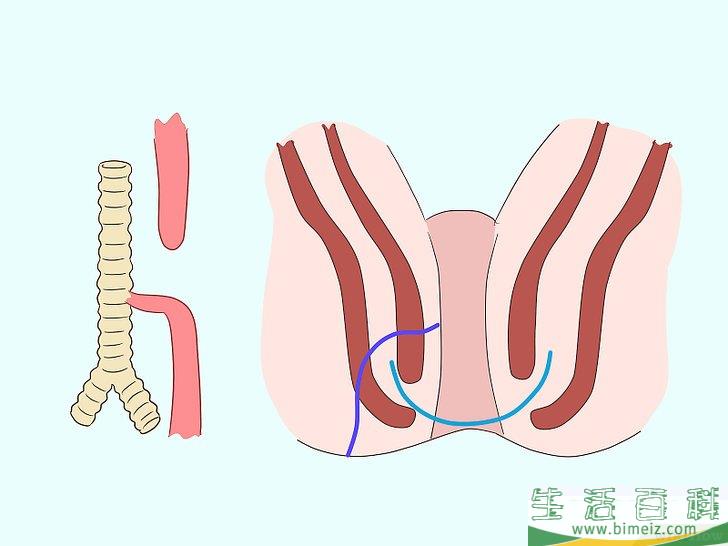 怎么治疗瘘管