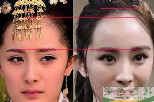发际线可以自行恢复吗 发际线后移的原因