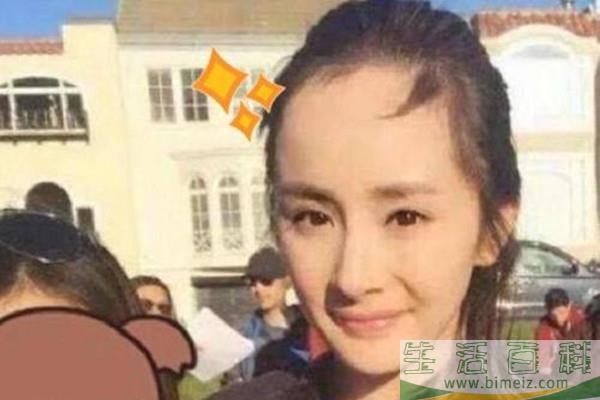 发际线可以自行恢复吗 发际线后移的原因