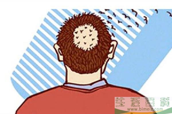 植发毛囊存活率高吗 植发毛囊不够怎么办