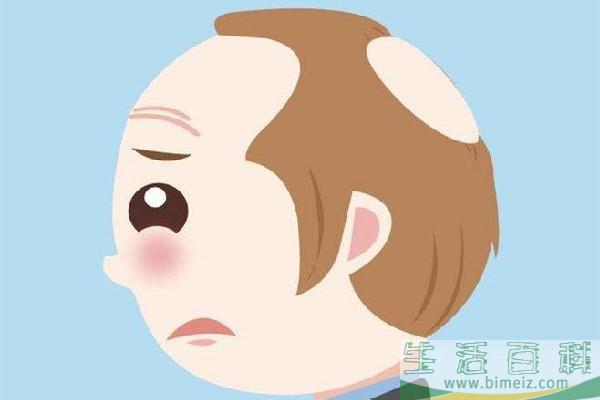 植发用的是哪里的毛囊 植发会不会有什么副作用