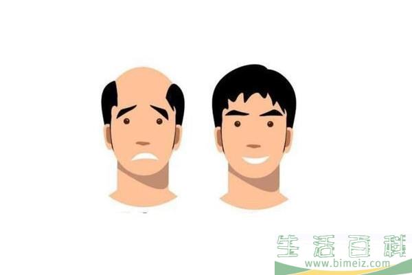 植发会不会再次脱落 植发用的是自己的头发吗