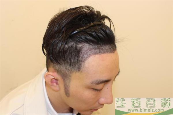 发际线后移是什么原因引起的 怎么防止发际线后移