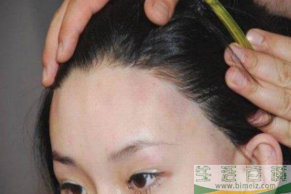 怎么样让发际线变低 如何让发际线前移