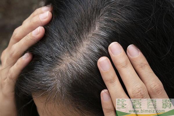 什么是毛发移植 毛发移植安全吗