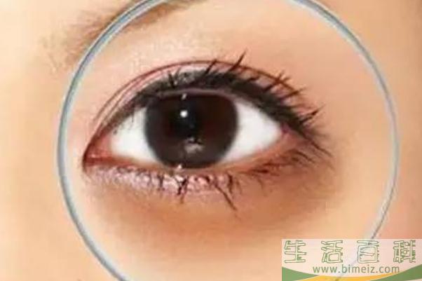 黑眼圈很重怎么去除 黑眼圈为什么很重