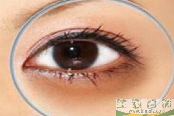 黑眼圈有天生的吗 黑眼圈有白色颗粒是什么
