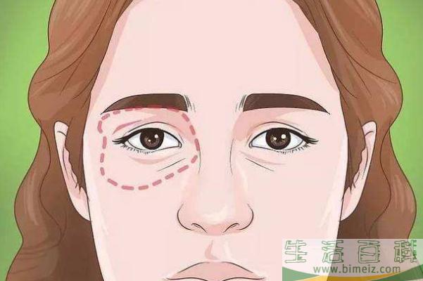 黑眼圈有天生的吗 黑眼圈有白色颗粒是什么