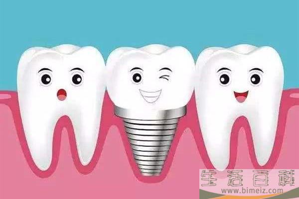 种牙多少钱一颗啊 种牙需要多少时间