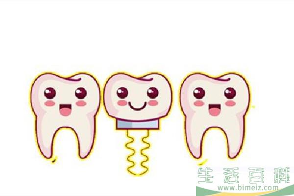 种牙会疼吗 种牙后疼痛多长时间能好