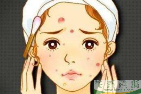 青春痘是皮肤病吗 青春痘要挤掉吗