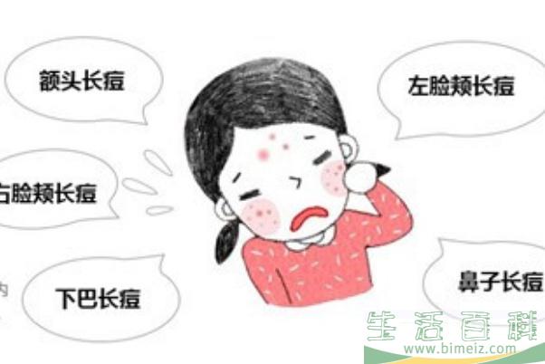青春痘是皮肤病吗 青春痘要挤掉吗