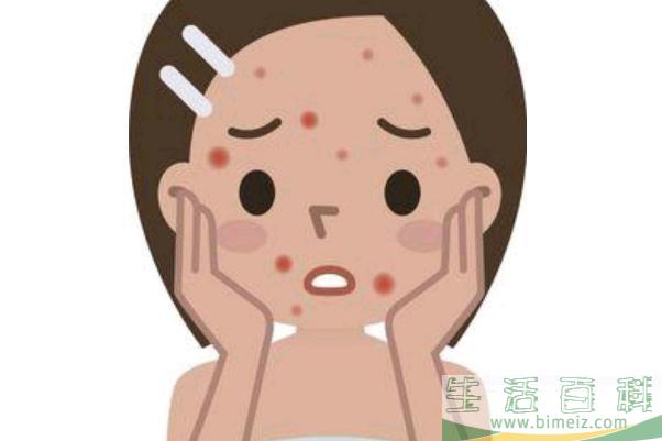 青春痘留下的疤痕怎么才能消除掉 青春痘和痤疮有什么区别