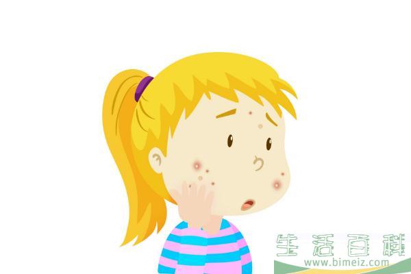青春痘的原因是什么 青春痘的痘印怎么消除